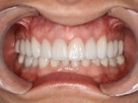 Konig Center for Cosmetic & Comprehensive Dentistry smile photos